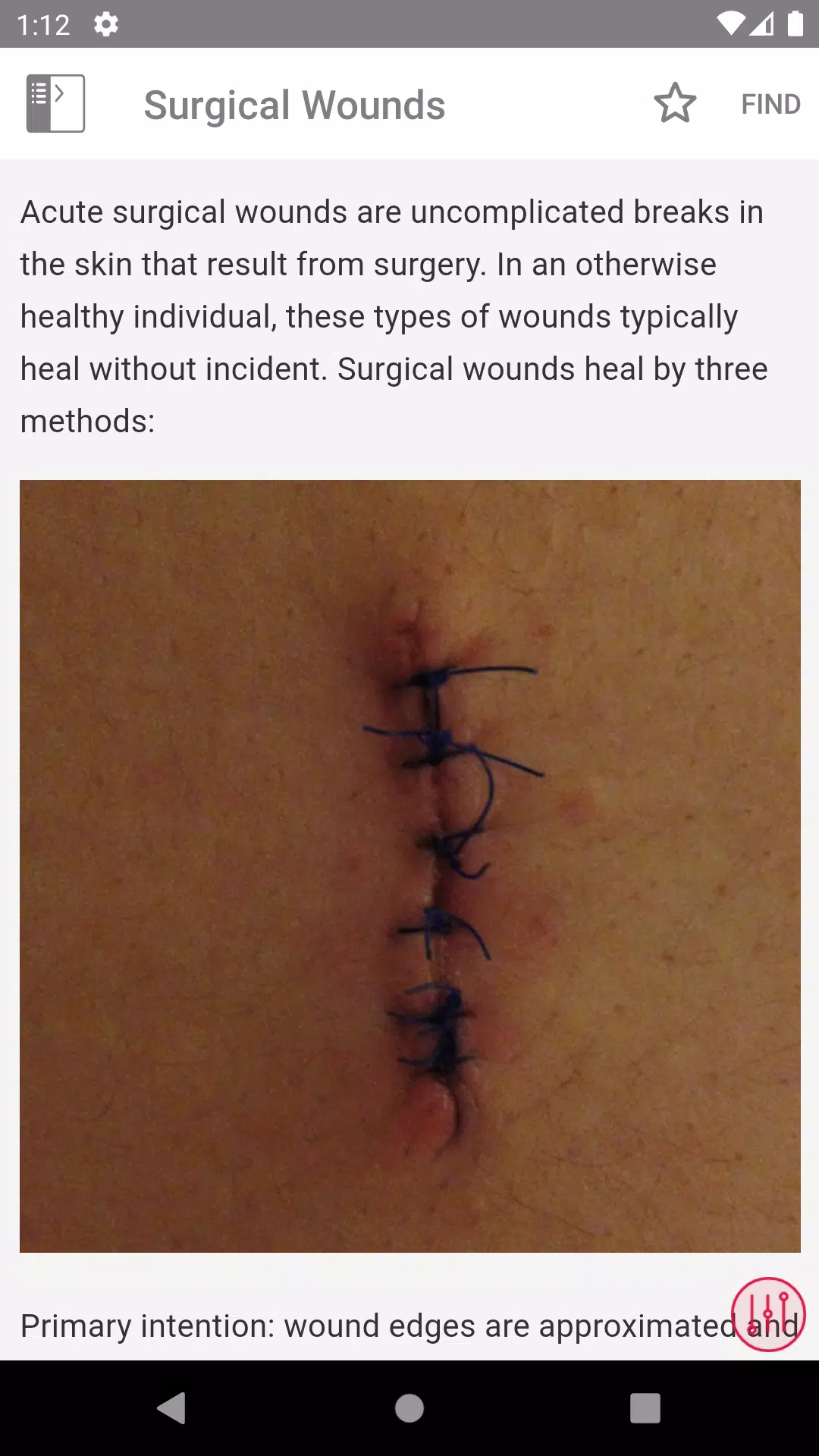 Wound Care MI Visual स्क्रीनशॉट 3