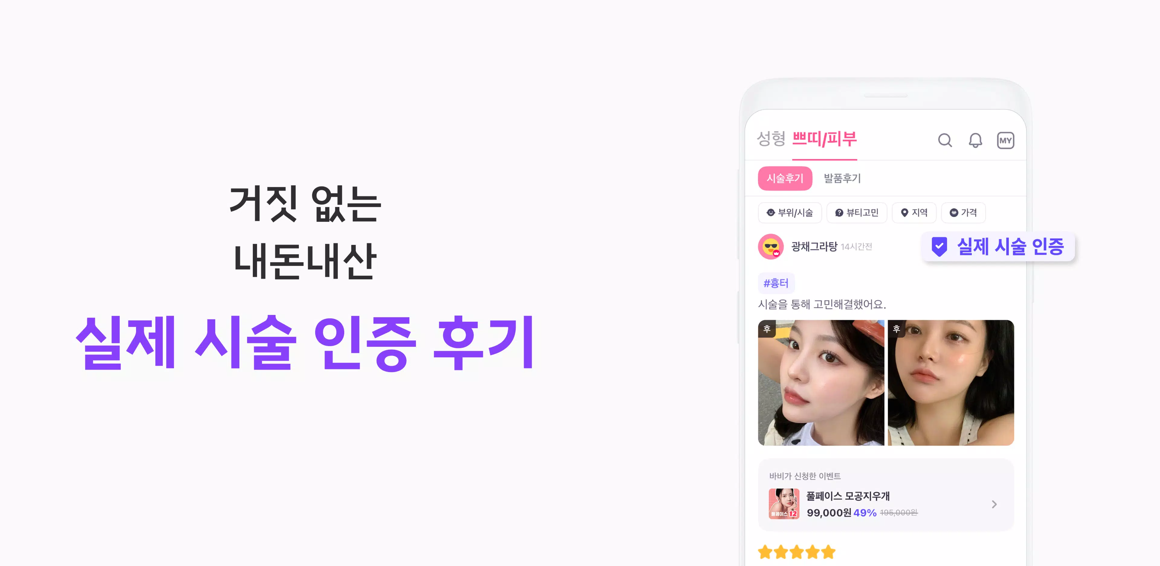 바비톡 - 성형 시술 성형외과 피부과 병원예약 성형어플 Screenshot 1